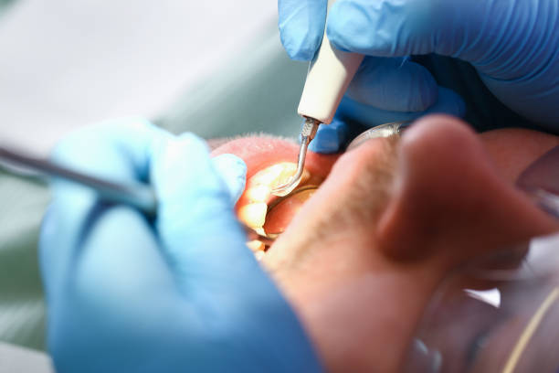 Best Root Canal Emergency Dentist  in Landis, NC